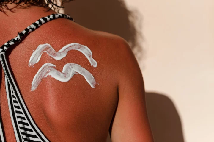 The truth about applying after-sun on sunburnt skin, according to the experts
