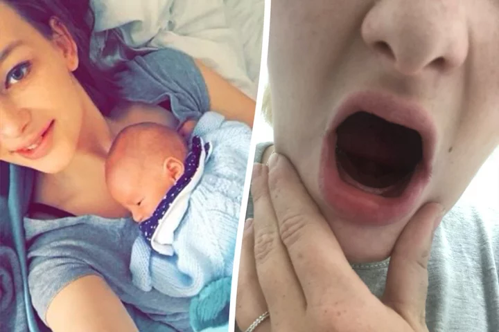 New mum has all teeth removed after rare condition made them fall out during pregnancy