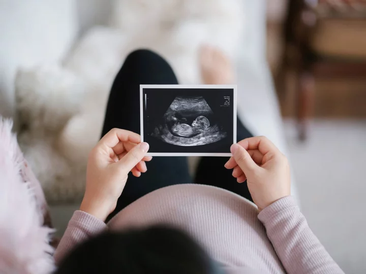 Unborn babies use ‘greedy’ father gene to get more nutrients from mothers, study finds