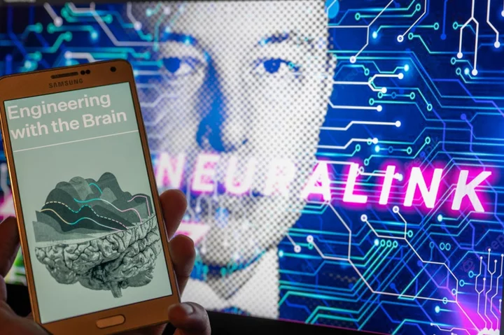Elon Musk's brain implant company Neuralink says the FDA has approved human trials