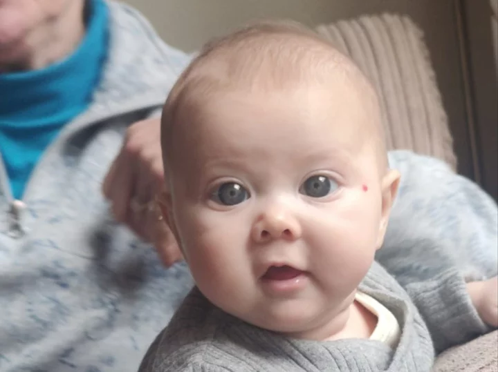 ‘My baby’s big blue eyes drew endless compliments - but they were the sign of a life-changing condition’
