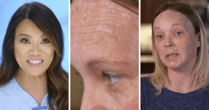 'Dr Pimple Popper' Season 9: Where is Cherish now? Dr Sandra Lee treats patient's 'leopard spots' on face post delivery