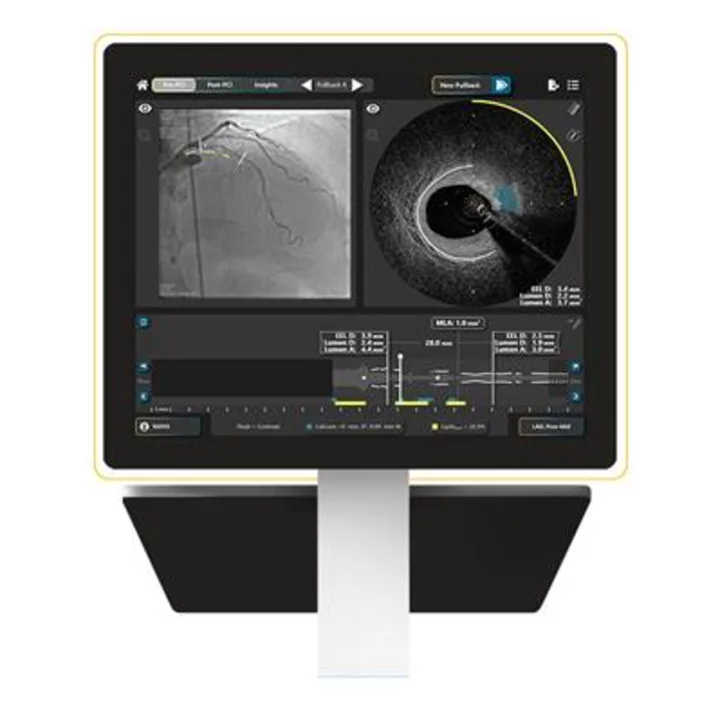 SpectraWAVE Secures 510(k) Clearance to Add Saline Imaging and Expanded Artificial Intelligence Features to the HyperVue™ Imaging System