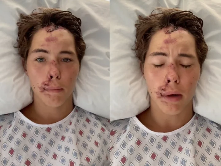 Influencer Caleb Coffee hospitalised after falling off cliff in Hawaii