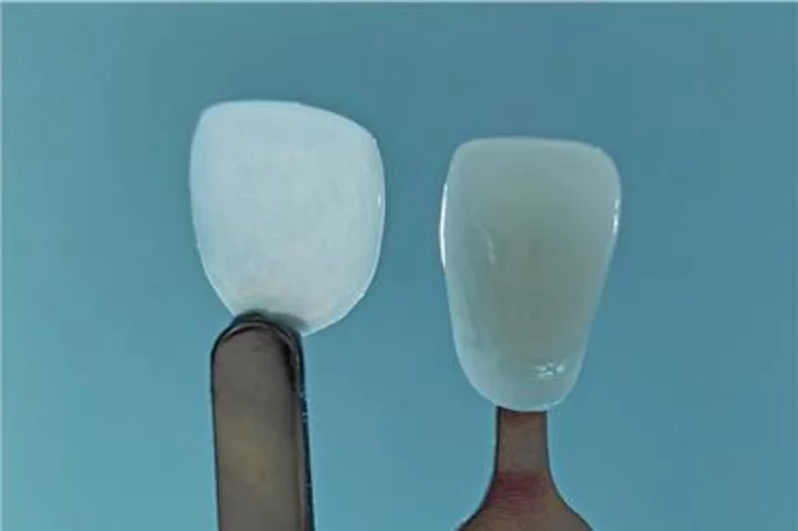 Boston Micro Fabrication to Market World’s Thinnest Cosmetic Dental Veneer