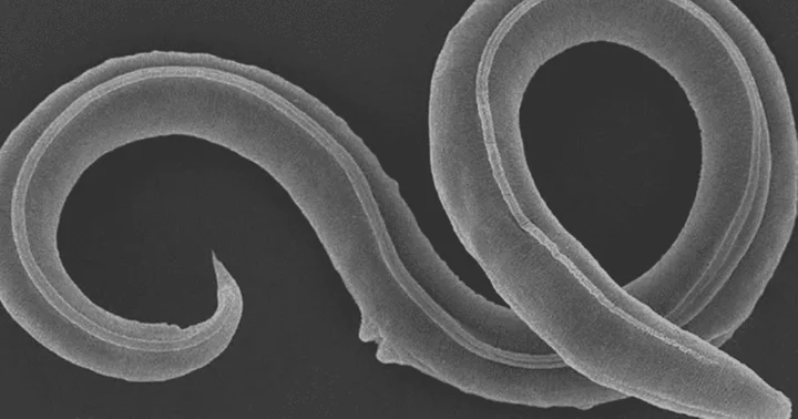 What is Panagrolaimus kolymaensis? Here's why scientists revived worm that has been dormant for 46,000 years