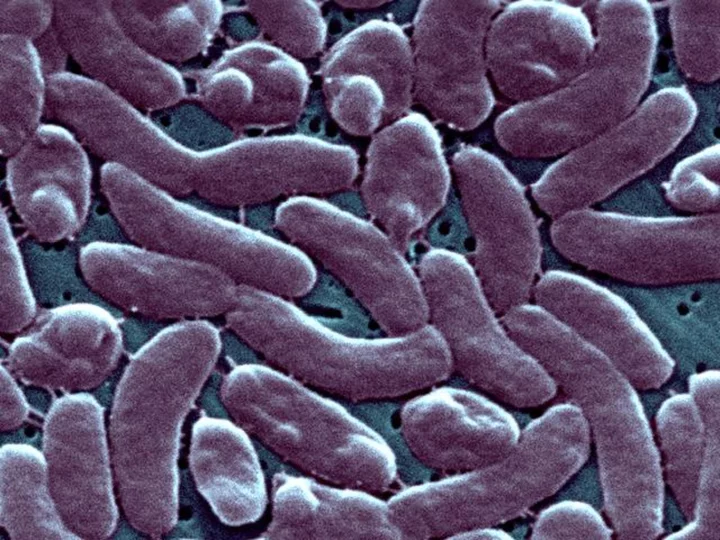 3 people have died after infection with rare flesh-eating bacteria in Connecticut and New York