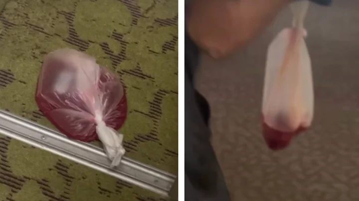 Woman horrified to find 'bag of blood' in hotel room