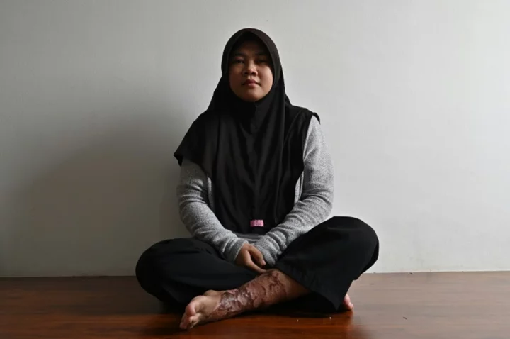 Indonesian maid's torture highlights lack of legal protections